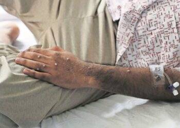 OMS levanta emergencia internacional por la viruela del mono