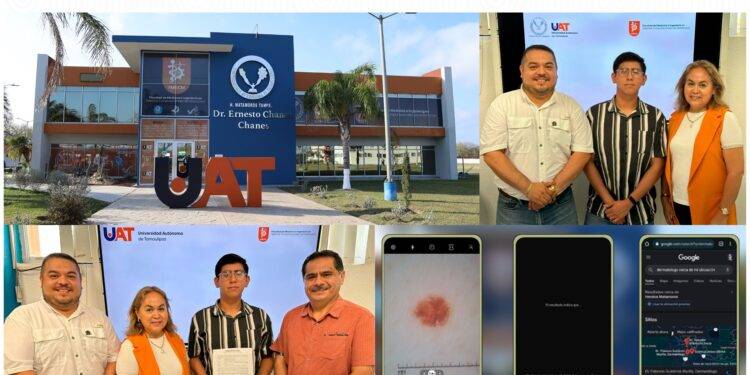 UAT desarrolla una aplicación móvil para detectar enfermedades de la piel